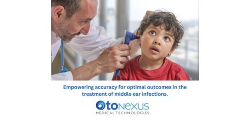 OtoNexus Medical Applied sciences Chosen for Elite FDA STeP Program – The Journal of Healthcare Contracting