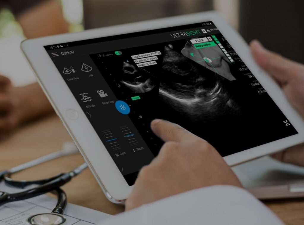 UltraSight, SELVAS Healthcare Associate to Carry AI-Powered Cardiac Ultrasound to Asia