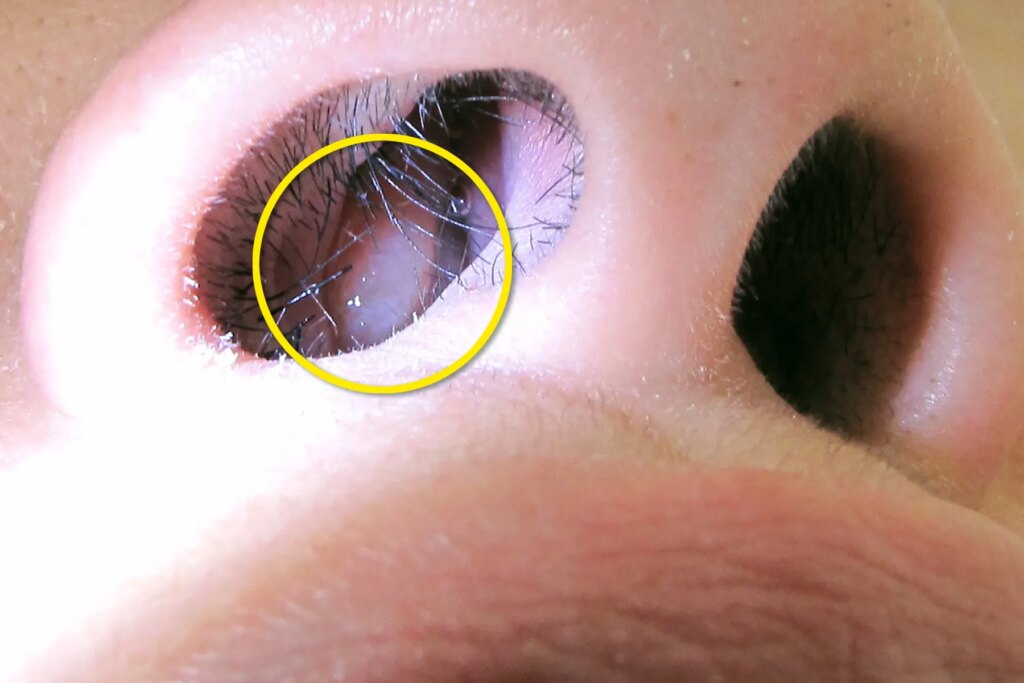 Why do I’ve nasal polyps?