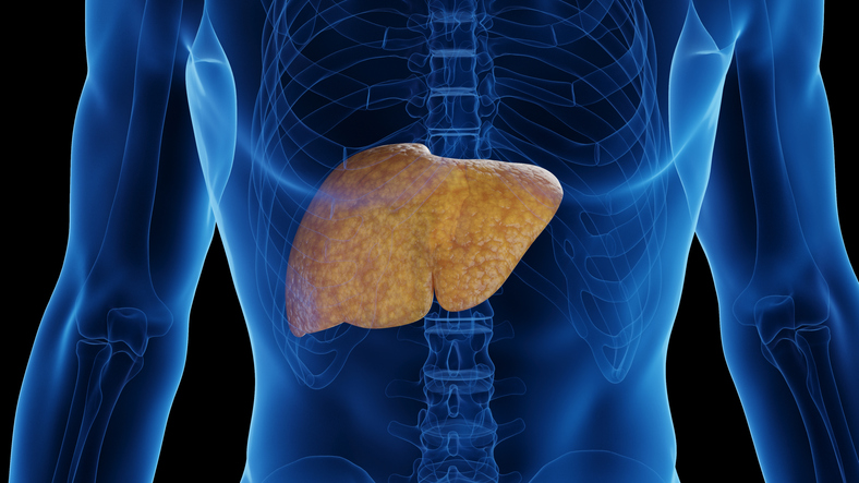 Ipsen, Genfit Drug Missed in MASH, Wins FDA Approval for A lot Uncommon Liver Illness