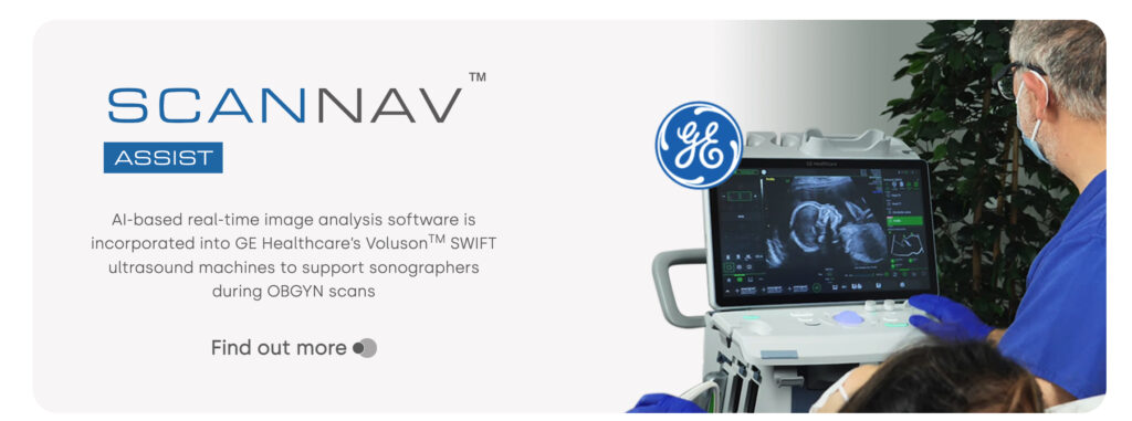 GE HealthCare to Purchase Clever Ultrasound Know-how for $51 Million