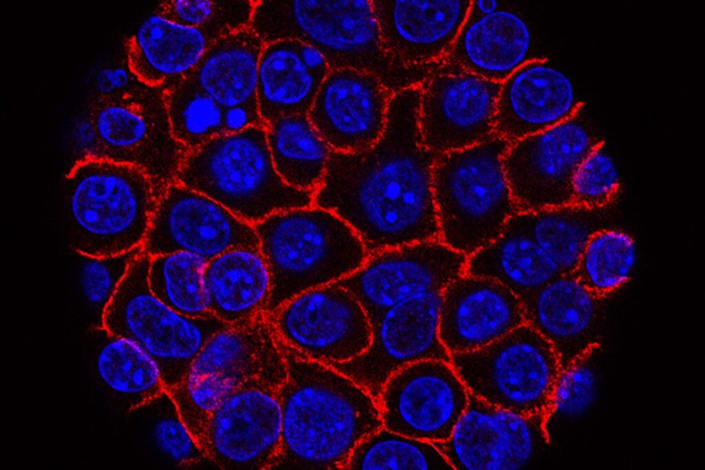 Optimistic pancreatic most cancers knowledge paves method for pivotal trial of Revolution Medicines drug