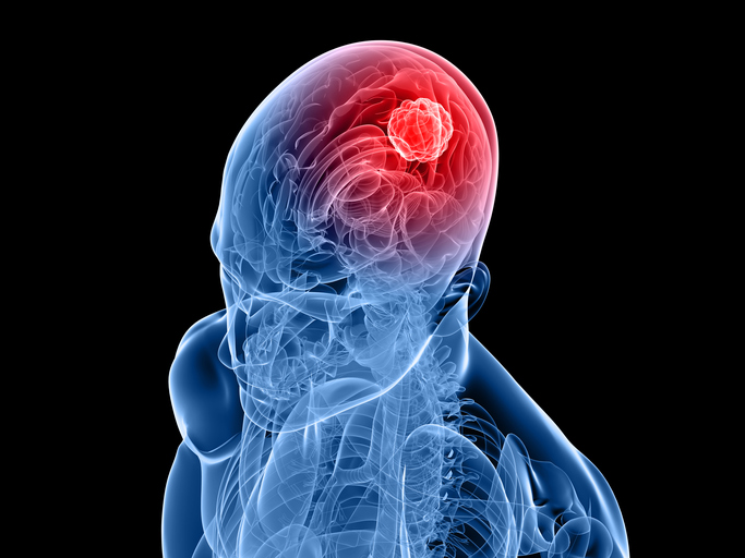 Main Servier acquisition pays off, FDA approves drug for 2 kinds of uncommon mind tumors