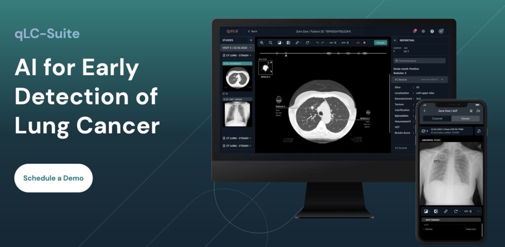 Qure.ai Receives FDA Clearance for AI-Powered Lung Nodule Evaluation Software –