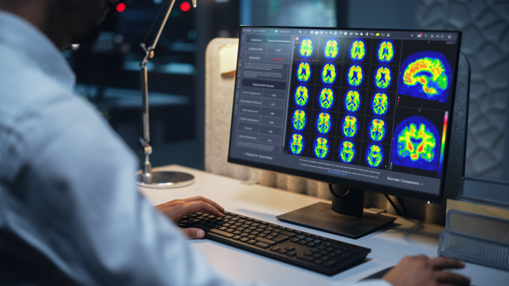 GE HealthCare receives FDA approval for imaging software for Alzheimer's illness