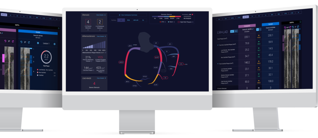 Medicare approves Cleerly's AI-powered coronary heart scan