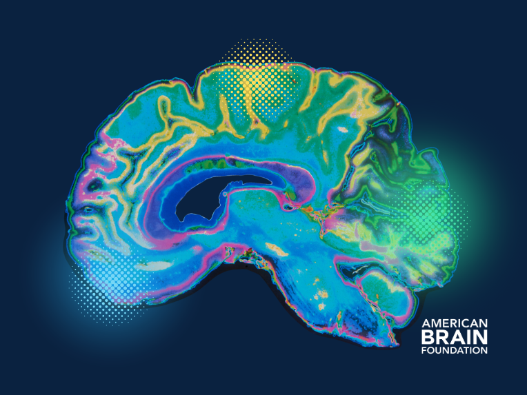 American Mind Basis Launches $10 Million Neuroinflammation Analysis Initiative –