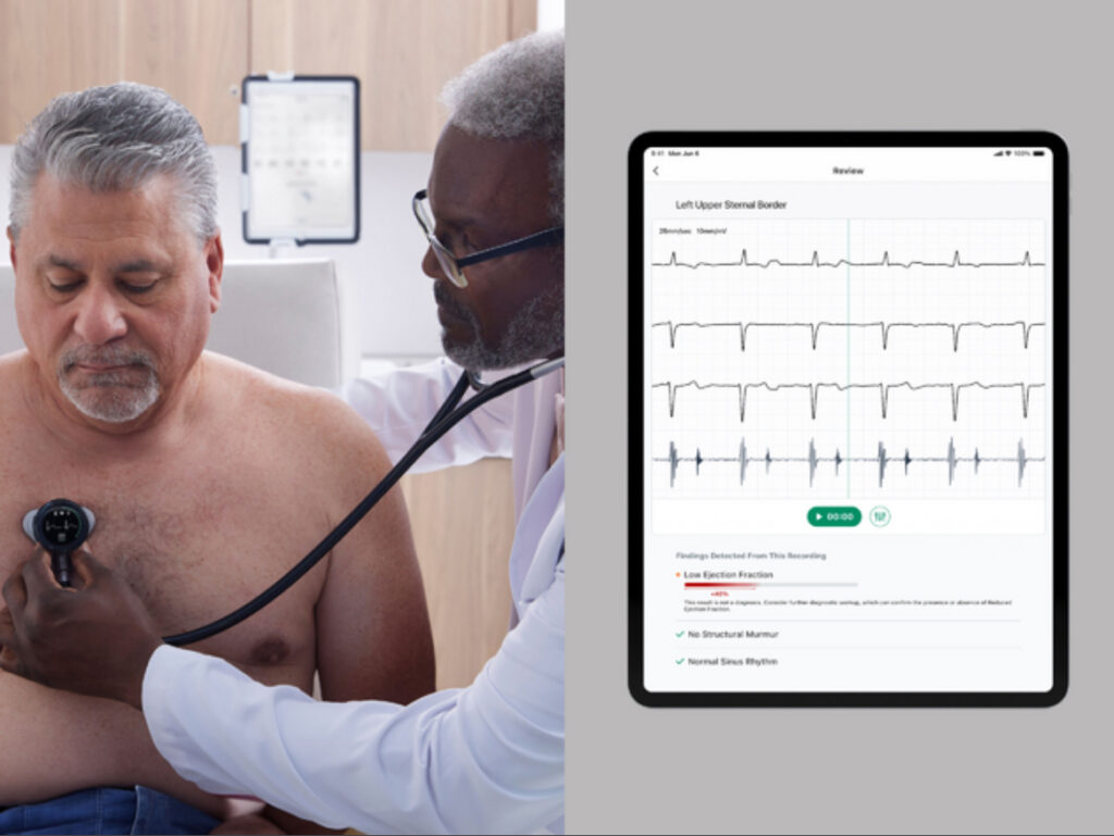 AMA Releases CPT Code for Eko Well being's AI-Powered Coronary heart Screening Device –