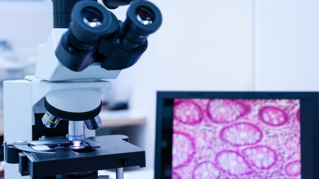 Hospitex strives for the cytology know-how contract with the Italian hospital