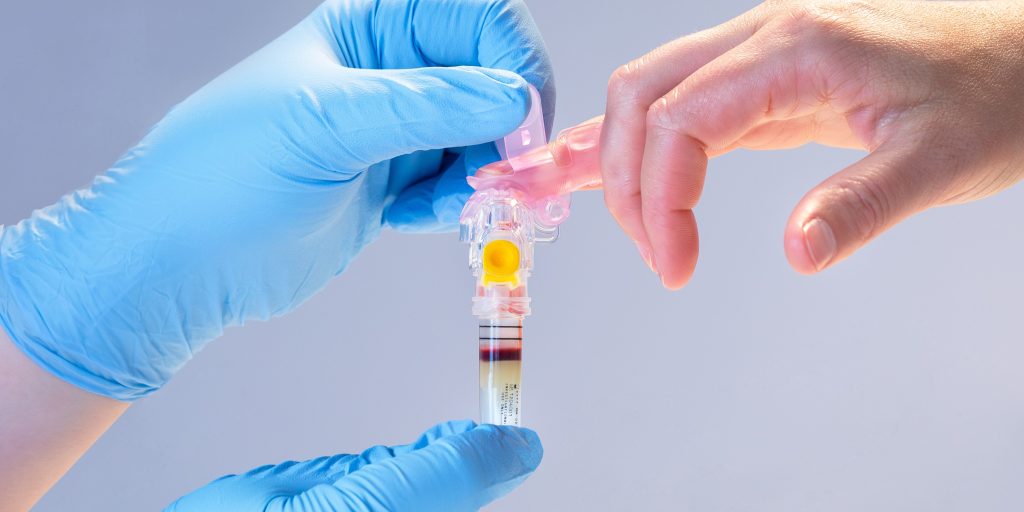 New BD Fingertip Blood Assortment Gadget has an equal check accuracy of attracts with a better quantity of vein-the journal of healthcare contracting