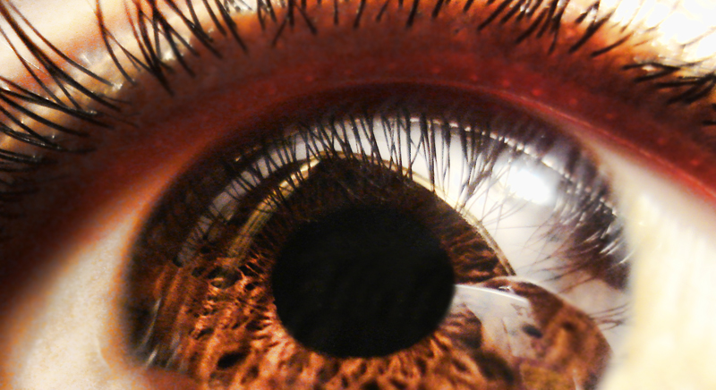 How one Well being System Diabetic Retinopathy screening in main care care