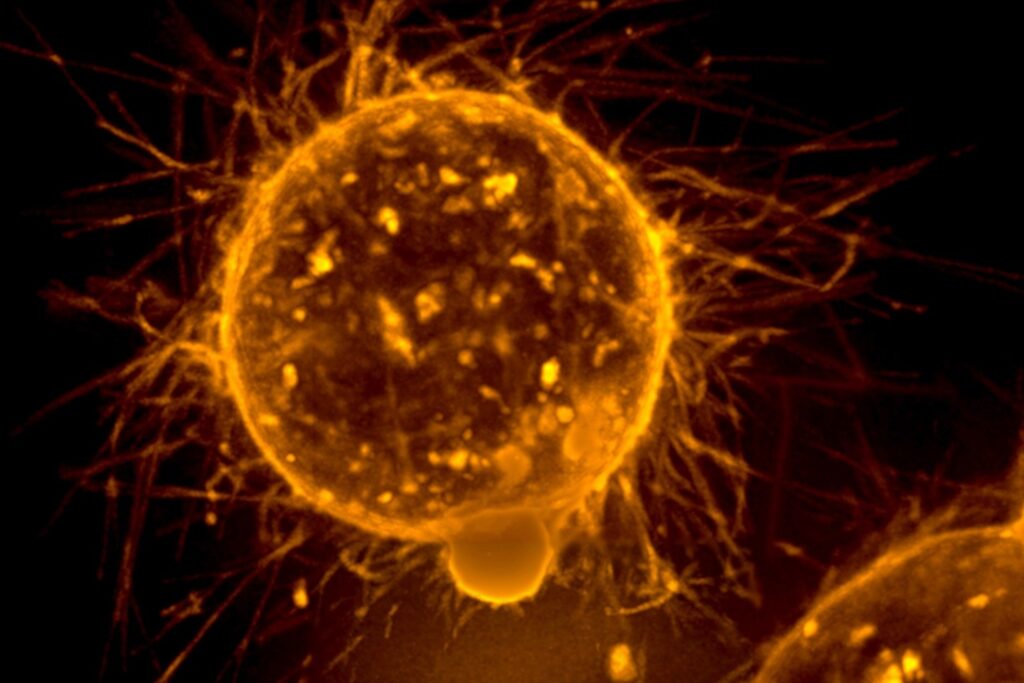 AstraZeneca & Daiichi Sankyo's Enerbertu posts constructive knowledge reminiscent of major care breast most cancers remedy