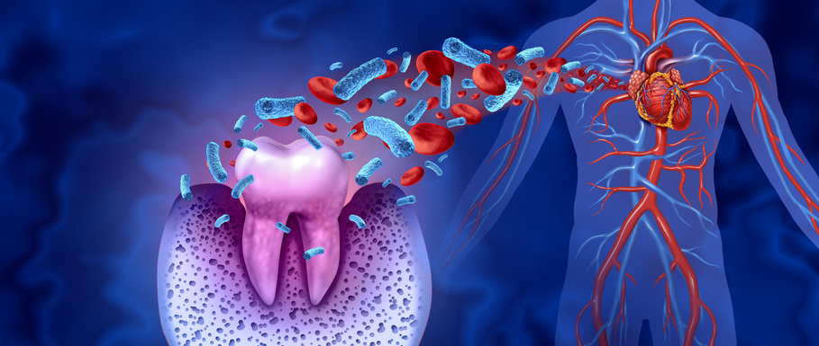 If we handled tooth decay as we deal with coronary heart situations, we’d save billions If we handled tooth decay as we deal with coronary heart situations, we’d save billions