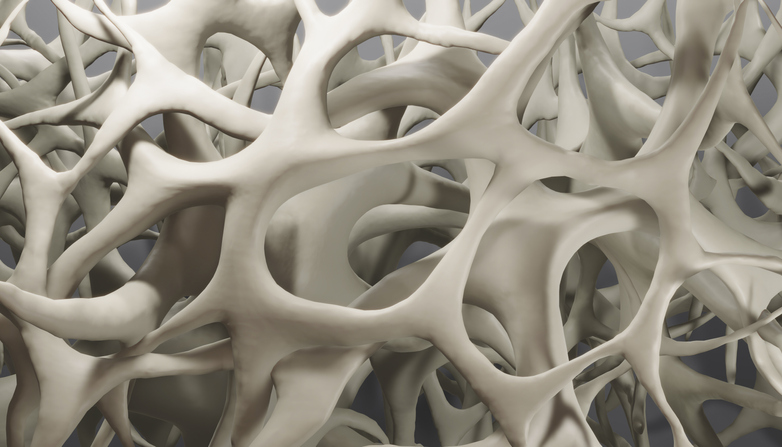 Atherosclerosis and osteoporosis: a narrative about two problems Atherosclerosis and osteoporosis: a narrative about two problems