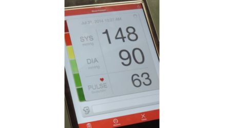 New guideline with hypertension emphasizes prevention, early remedy to cut back the CVD threat – the Journal of Healthcare Contracting