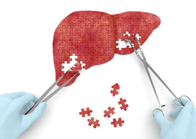 Lengthy regulating Saga for intercepting pharmaceutical liver drug ends ten years after quick FDA approval Lengthy regulating Saga for intercepting pharmaceutical liver drug ends ten years after quick FDA approval