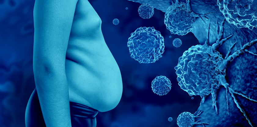 Weight problems, most cancers and the brand new restrict of therapy