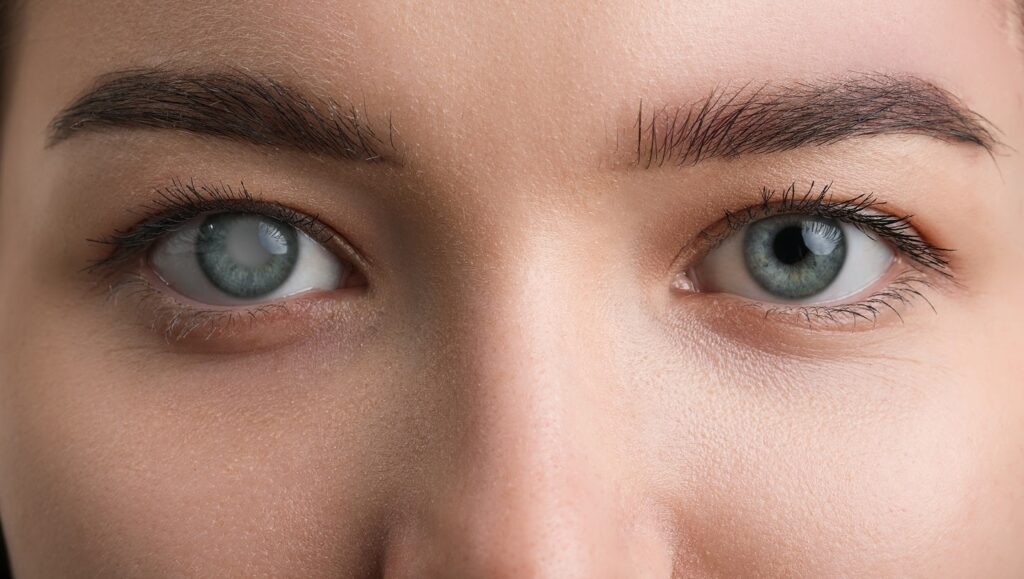 Myra Imaginative and prescient is enrolling the primary affected person in a trial of the Calibreye glaucoma system Myra Imaginative and prescient is enrolling the primary affected person in a trial of the Calibreye glaucoma system