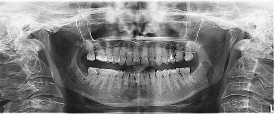 How a number one DSO used analytics to realize a 26% improve in crown therapy planning