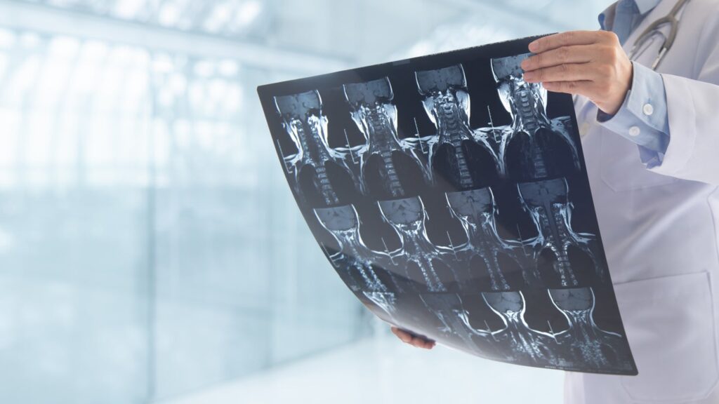 VB Backbone acquires xvision Backbone System from Augmedics