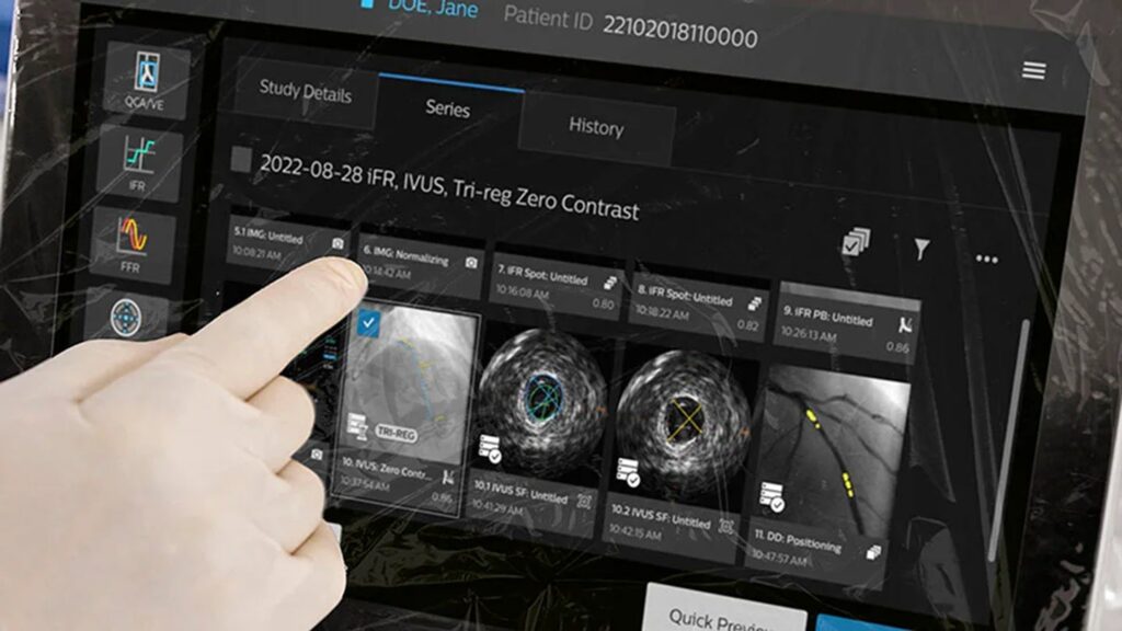 Philips introduces the intervention platform IntraSight Plus Philips introduces the intervention platform IntraSight Plus