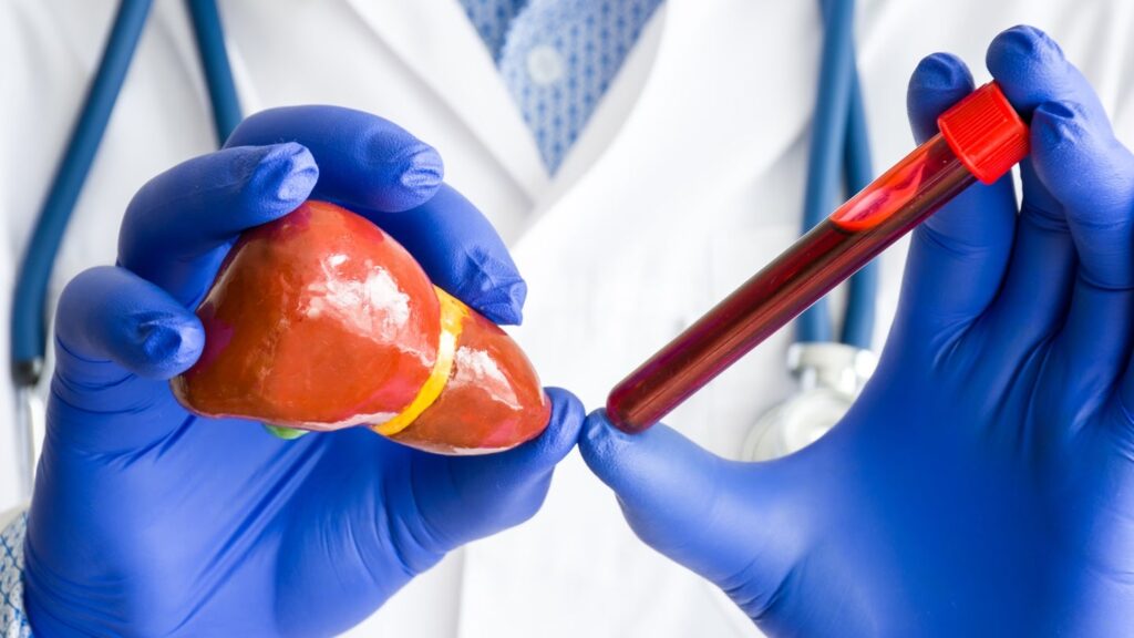 ENDRA stories favorable information from the Taeus Liver Units examine in MASLD