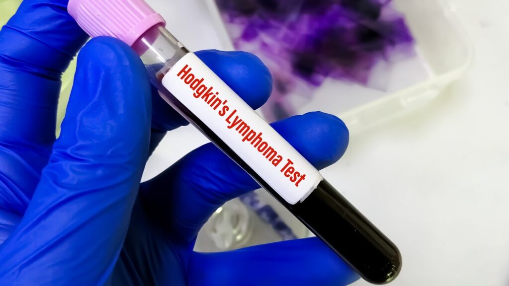 BMS secures FDA and EC approvals for Opdivo in Hodgkin’s lymphoma