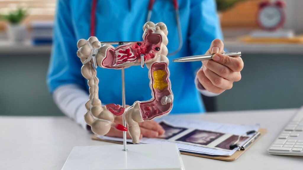 MSD and Quotient collaborate on IBD drug targets