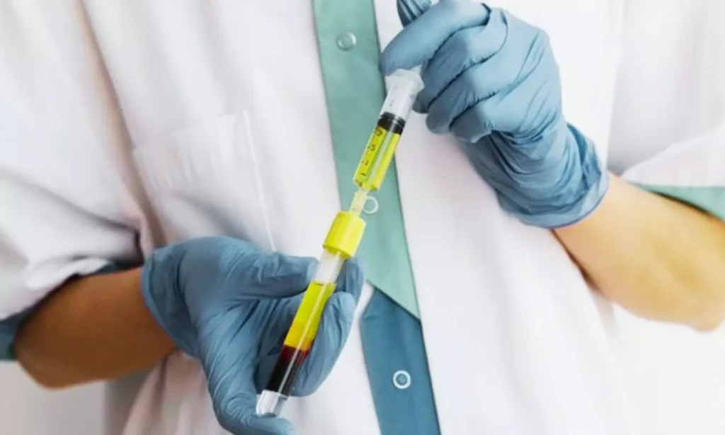 Vaginal PRP remedy improves sexual operate in premenopausal girls, in accordance with randomized research