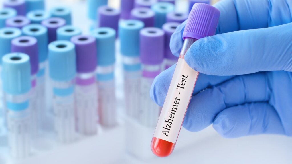 Actinogen Treats First Affected person in XanaMIA Trial for Alzheimer’s Illness