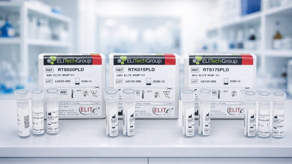 Bruker unveils MyGenius PRO diagnostic system