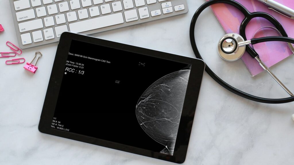 Artera’s prostate biopsy and breast most cancers exams obtain a CE mark