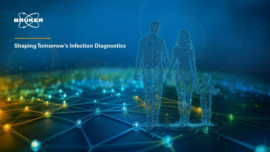 Rethinking the microbiology workflow with smarter instruments for sooner solutions and fewer waste